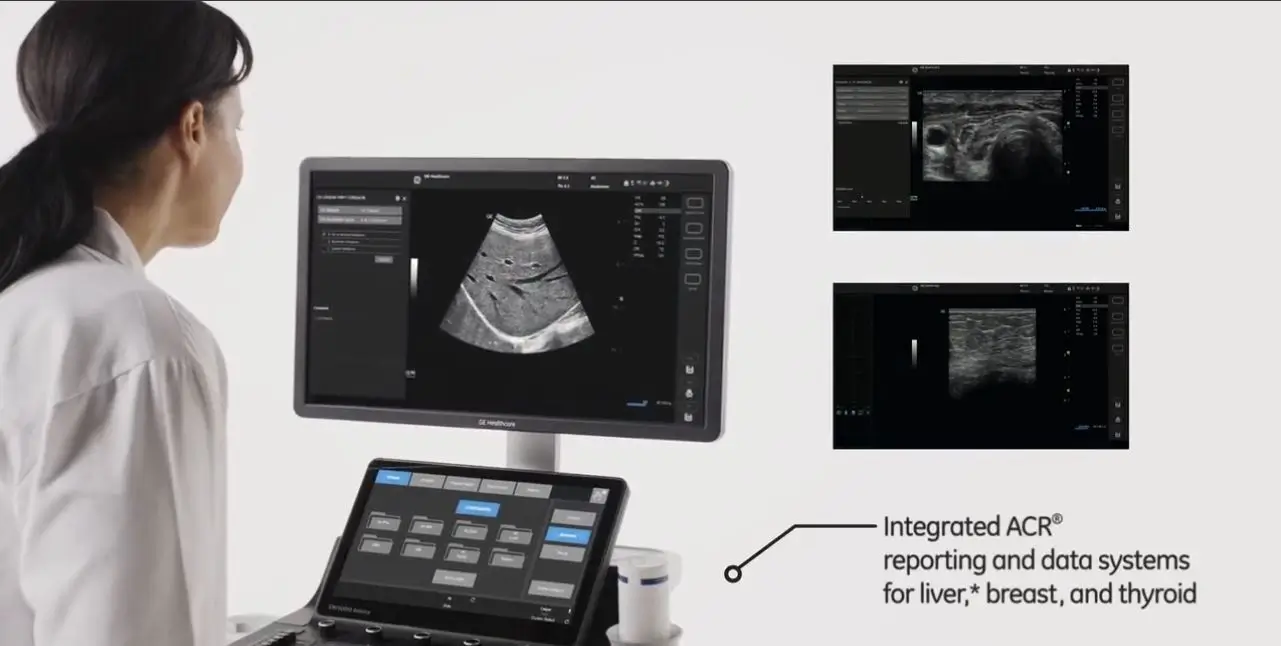 GE Versana Balance ultrasound machine used at Orbit Diagnostics & Healthcare Srinagar